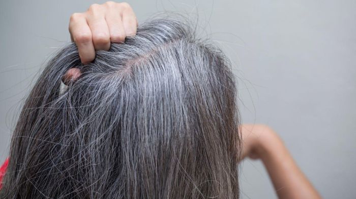 جلوگیری از سفیدی مو